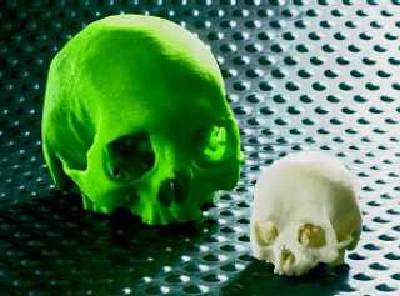 Medical models produced with the Z-Corp 3D printer from scan data. Medical models produced with the Z-Corp 3D printer from scan data.