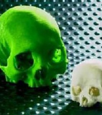 Medical models produced with the Z-Corp 3D printer from scan data.