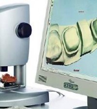 Constructing dental prostheses onscreen: Sirona CAD/CAM workstation with 3D scanner.